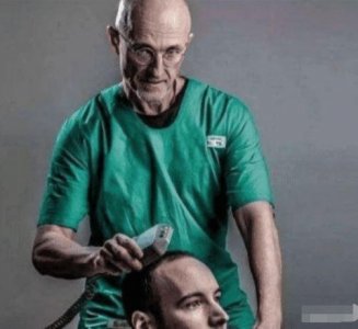 世界首例成功“换头”手术,历时18小时耗费7千万,现状如何?