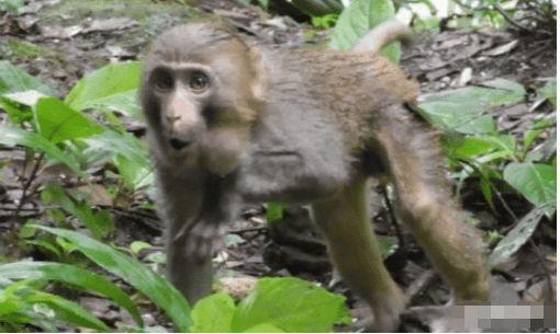 世界首例成功“换头”手术，历时18小时耗费7千万，现状如何？