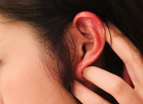 李小璐事件让安以轩不敢做发型?在家做头发被老公烫伤耳朵