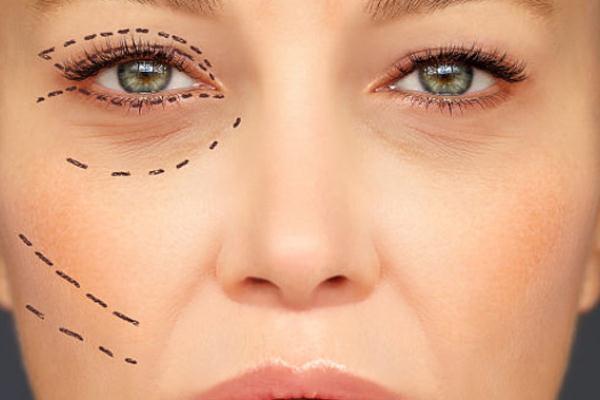 眼袋为什么有脂肪粒 眼袋为什么一个大一个小 眼袋为什么有脂肪粒 眼袋为什么一个大一个小