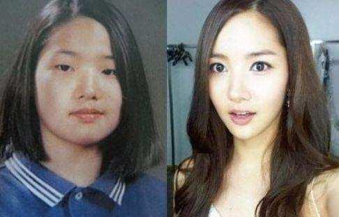 整容最多的女星, 前后简直彷若两人