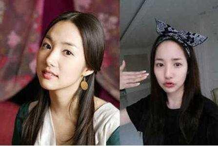 整容最多的女星, 前后简直彷若两人