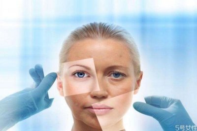 ​产后脸上长斑怎么办 产后脸上长斑什么原因