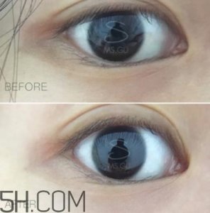 ​viicode眼膜有用吗？viicode眼膜评测