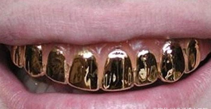 正常人有多少颗牙齿?传说32颗牙齿是富贵命,是真的吗?