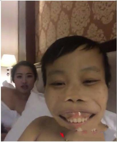 满口龅牙的他,竟一度成为网红