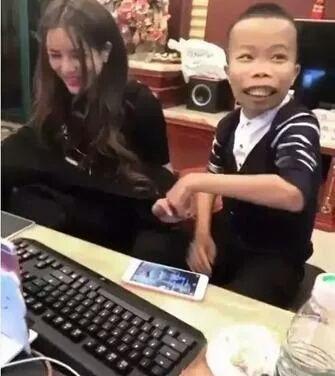 满口龅牙的他,竟一度成为网红