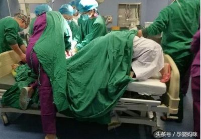 ​胎儿脐带脱垂危及生命，女医生跪托20多分钟，被成为“最美跪姿”