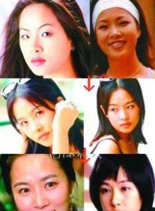 金善雅整容风波:揭秘她的真实变化与美丽真相