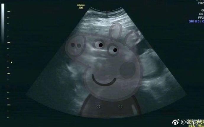 袁弘穿花衬衫和孕妇张歆艺同框,两人看着像姐妹,穿衣越来越像