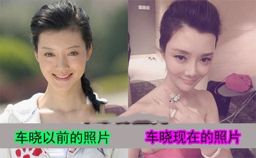 车晓无人娶的原因 整容过度与山西首富离婚内幕曝光