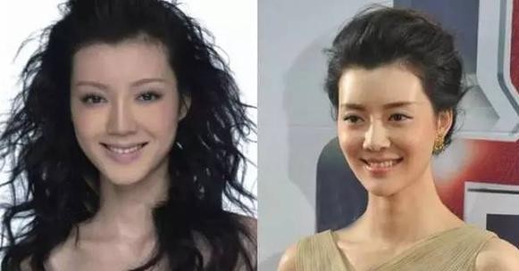 车晓无人娶的原因 整容过度与山西首富离婚内幕曝光