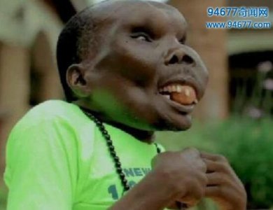 盘点世界上最丑的人,丑到让人无法直视(图片慎点)