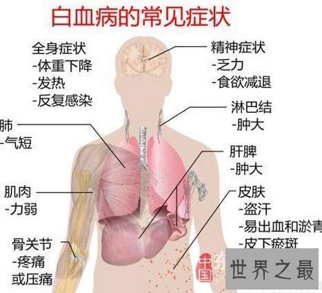 盘点世界五大绝症,如不解决恐毁灭人类
