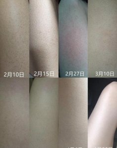 有什么方法可以快速去鸡皮(去鸡皮的小妙招)