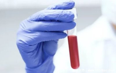 a型血为什么叫贵族血,最常见反而是其最大的优势