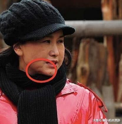 她是《重案六组》最美警花,嫁大23岁导演,如今整容失败面目全非