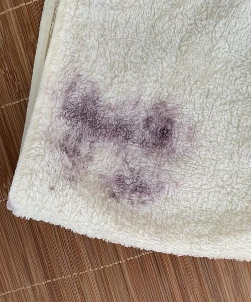 卫生间毛巾上出现黄斑是怎么回事