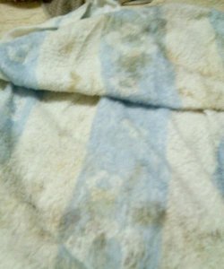 毛巾上有黄斑怎么回事,新毛巾用了几天有黄点是什么原因呢