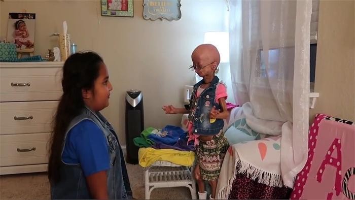 世界上很年轻的“老太太”,12岁就长成80岁模样,这是什么原