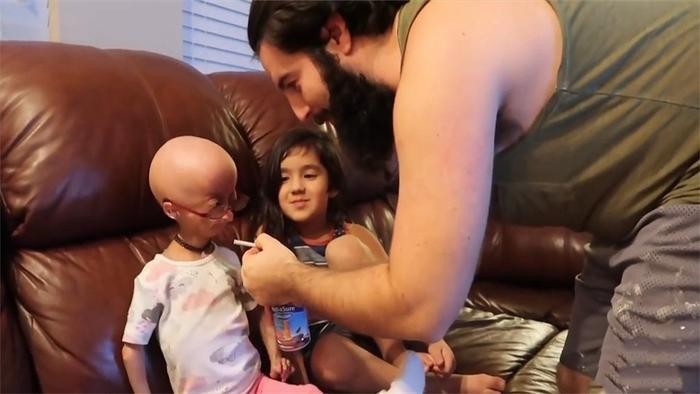 世界上很年轻的“老太太”,12岁就长成80岁模样,这是什么原