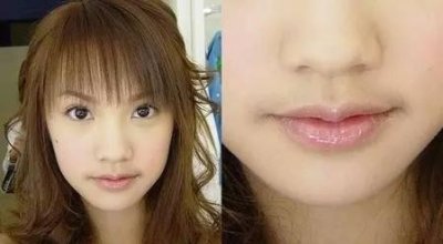 唇周暗沉怎么办(局部肤色暗沉怎么办)