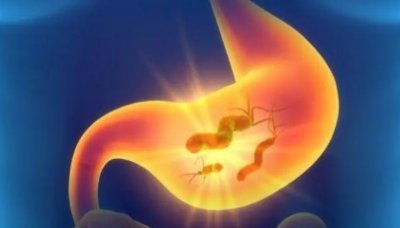 当代年轻人为什么胃病高发?