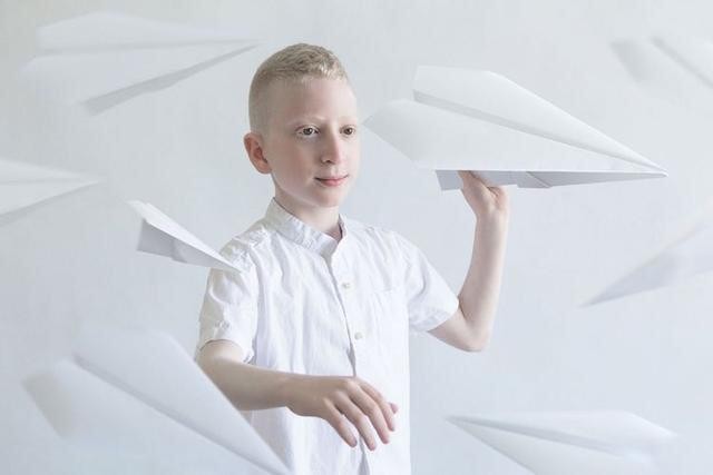 世界上最美的白化病女孩(摄影师捕捉白化病患者的空灵之美)(3)