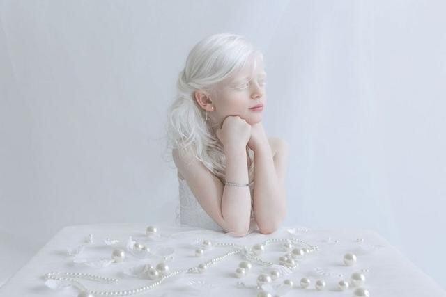 世界上最美的白化病女孩(摄影师捕捉白化病患者的空灵之美)(2)