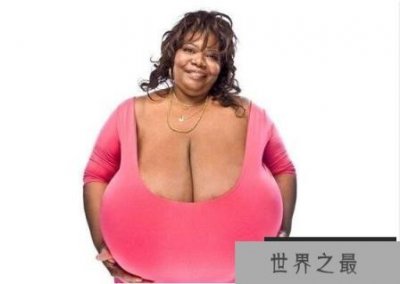 ​世界上最大的胸部，安妮·霍金斯特纳(胸部重达77斤)