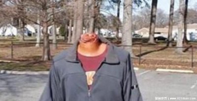 ​无头人真的存在过吗，真实存活15年的无头人(附真相图片)