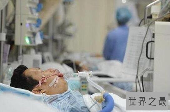 人类历史上最可怕的十大病毒，天花病毒死了1.5亿人