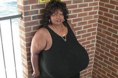 ​世界上最大的胸有多大，重达38.5公斤(一个小孩那么重)