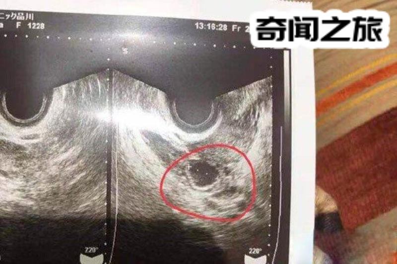 蒋劲夫家暴女友的原因(和很多男性友人一起去夜店玩)(1)_