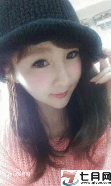 沈玉琳的眼睛怎么了 沈玉琳老婆牙牙资料照片