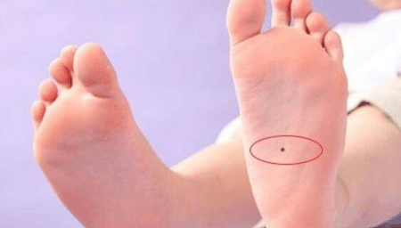 脚下有痣代表什么命运?脚下有痣好不好?