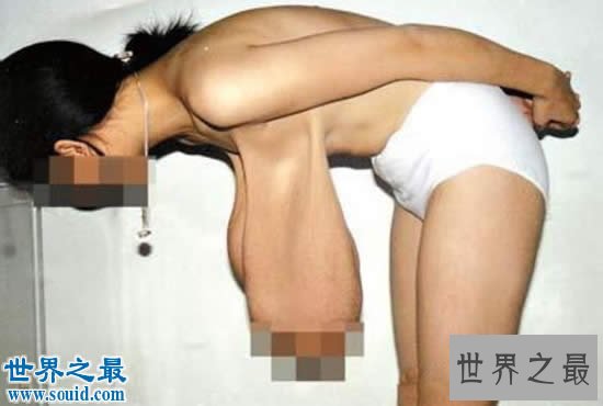 世界上乳房下垂最严重的女人，一直掉到大腿处(图)