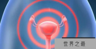 ​世界上最痛苦的疾病是一种无法忍受的疾病