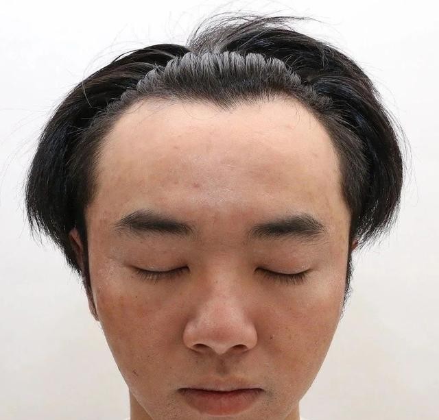 华晨宇整容前后照片(华晨宇从眼镜宅男到花样美男)