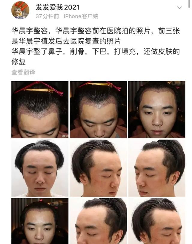 华晨宇整容前后照片(华晨宇从眼镜宅男到花样美男)