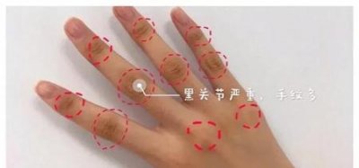 14岁美白方法(14岁学生快速美白的方法)