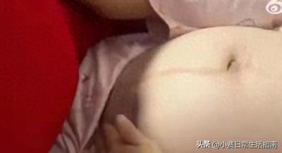 32周孕妇遭丈夫猛踢孕肚后续!皮肤青紫,知情人曝光内幕