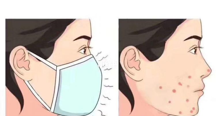 长期戴口罩会变丑吗