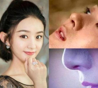 如何改善黑头和毛孔粗大(去黑头毛孔粗大小妙招)