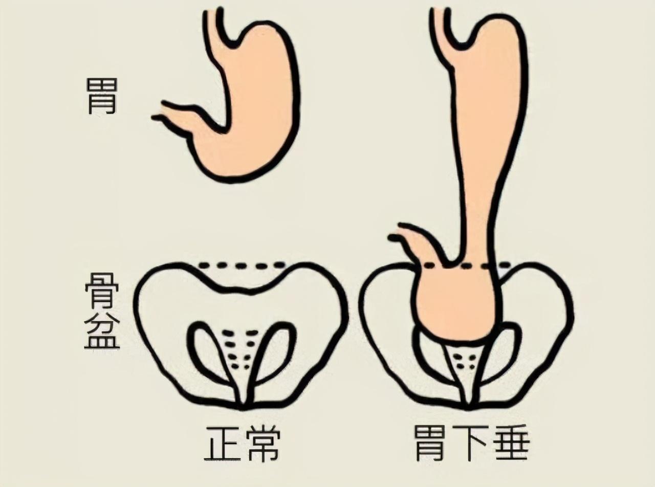 饭后百步走活到九十九有科学依据吗