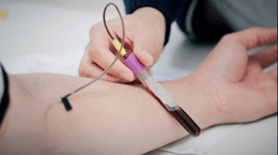 ​牢记血脂升高的5个信号！降血脂，这份最饮食攻略请收好！