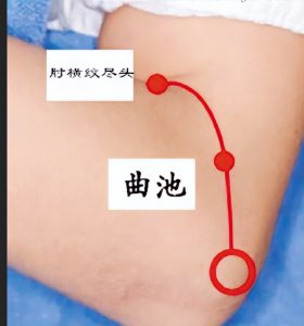 ​手五里——调理“肩周炎、偏瘫、落枕、嗜睡、颈淋巴结核”穴位