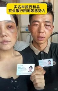 因妻子太美!夫妻俩被银行职员殴打囚禁照片曝光!凶手儿媳妇更美